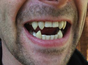 Perma-fangs